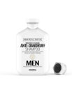 Immortal-Anti-Dandruff Shampoo Przeciwłupieżowy Szampon do Włosów 500ml